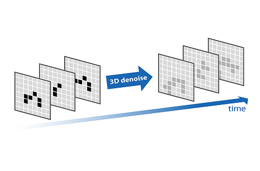 3D + 2D Digital Noise Reduction